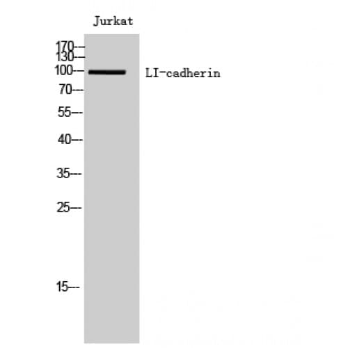 Polyclonal Rabbit anti-Human CDH17 / Cadherin 17 Antibody (310-390 aa, Internal, IHC, IF, WB)