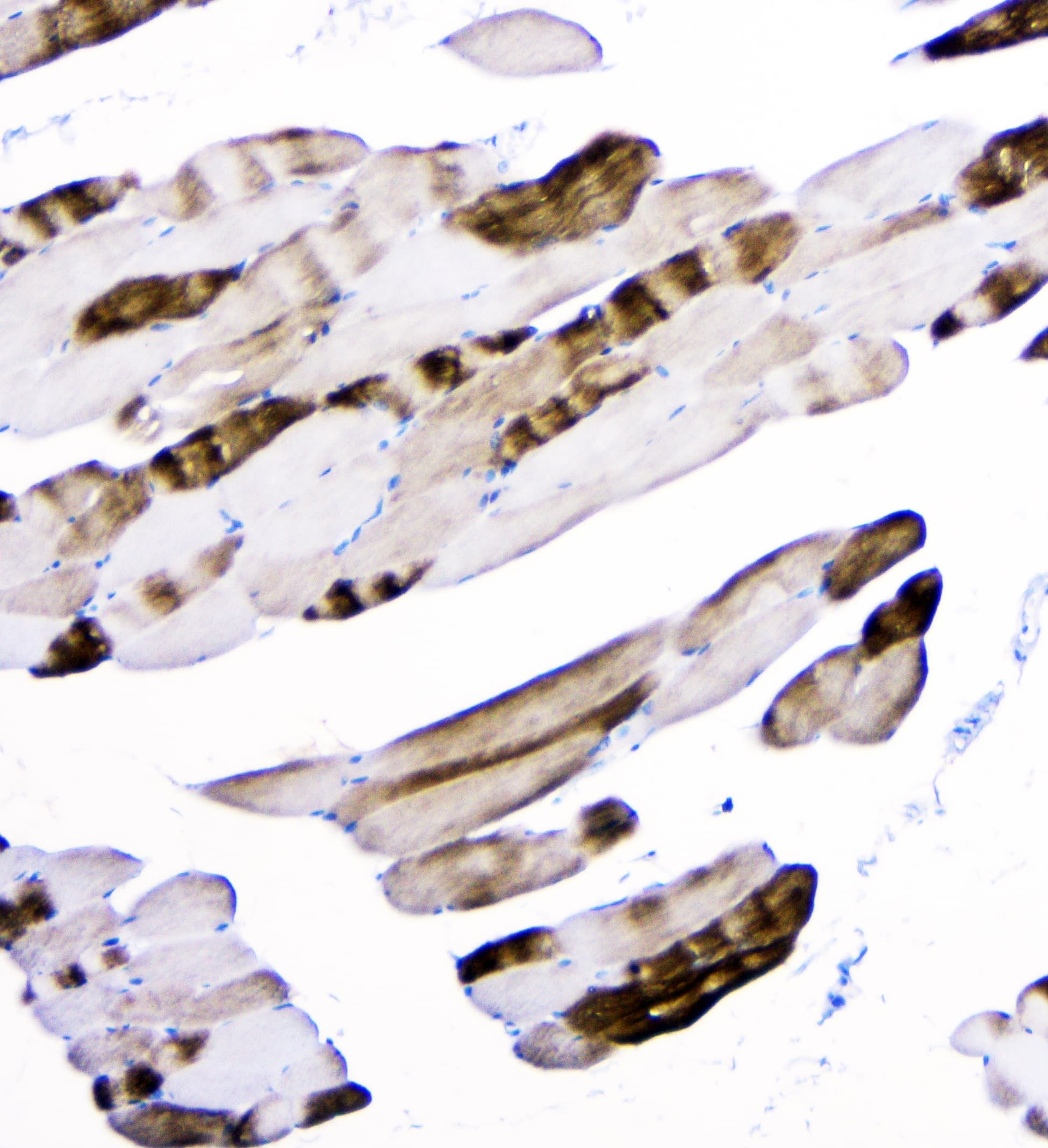 ACTN3 Antibody