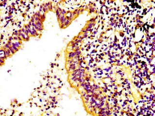 RPS6KA6 / RSK4 Antibody