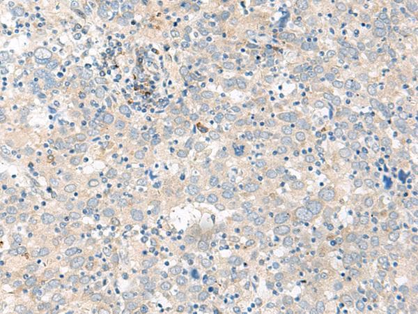 GCAP2 / GUCA1B Antibody