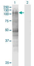 MSH2 Antibody (clone 2G9)