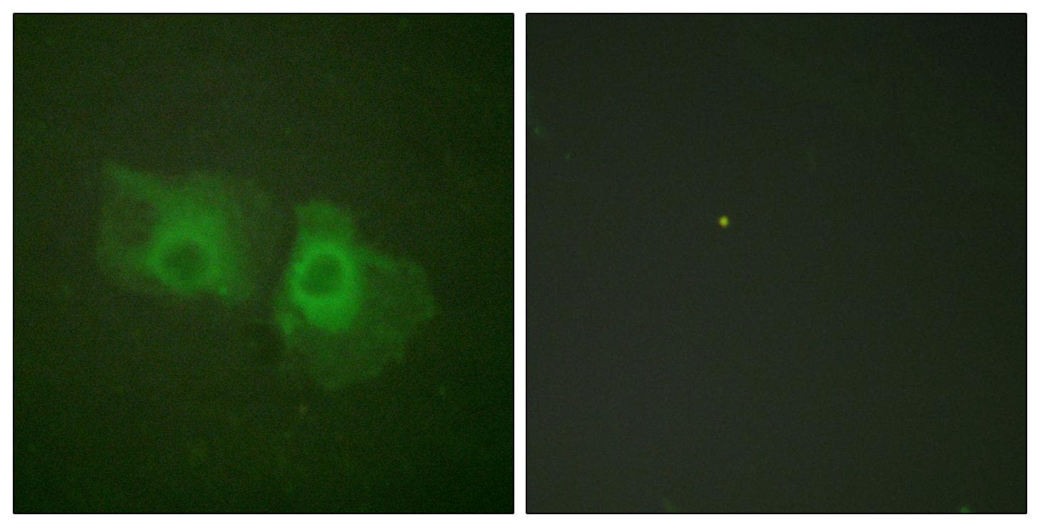 KRT18 / CK18 / Cytokeratin 18 Antibody (p33)