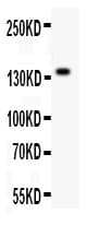 ZEB2 / SIP-1 Antibody (aa1-200)