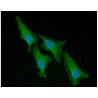 ACP1 / Acid Phosphatase Antibody (clone AT5C11)