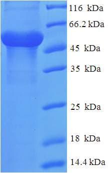 Human CTG-B45d / THAP11 Protein (Recombinant His-SUMO)
