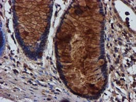 Complement C1s Antibody (clone OTI4E3)