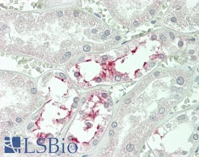 IHC-plus™ Polyclonal Rabbit anti-Human AQP2 / Aquaporin 2 Antibody (C-Terminus, IHC, IF, WB)
