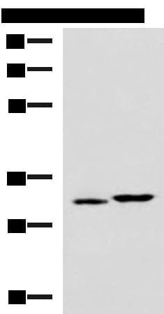 CBR3 Antibody