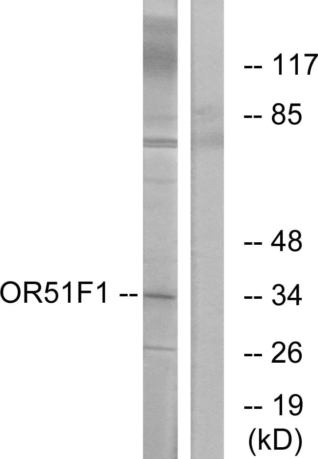 OR51F1 Antibody (aa269-318)