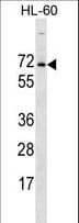 PXYLP1 / ACPL2 Antibody (aa306-335)