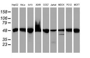 UQCRC1 Antibody (clone OTI1G2)