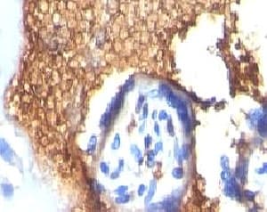 GYPA / CD235a / Glycophorin A Antibody (clone GYPA/280)