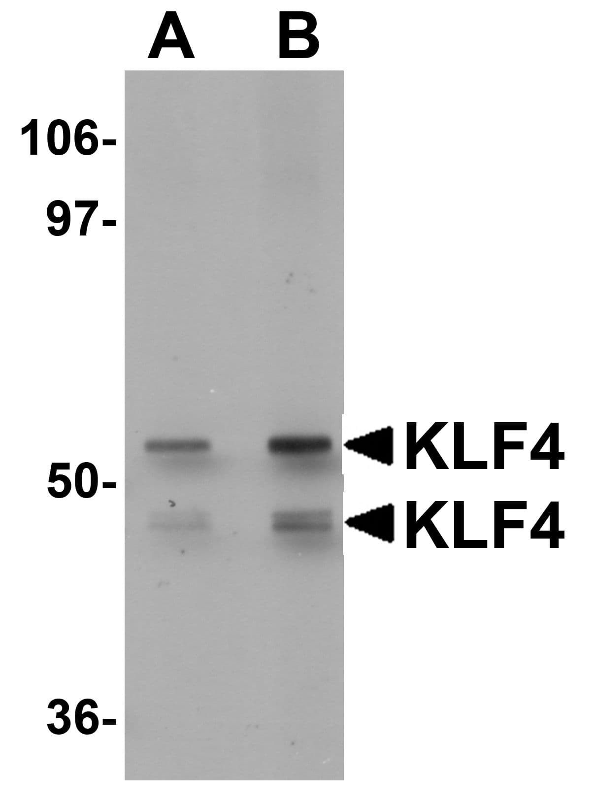 Polyclonal Rabbit anti-Human KLF4 Antibody (IHC, WB)
