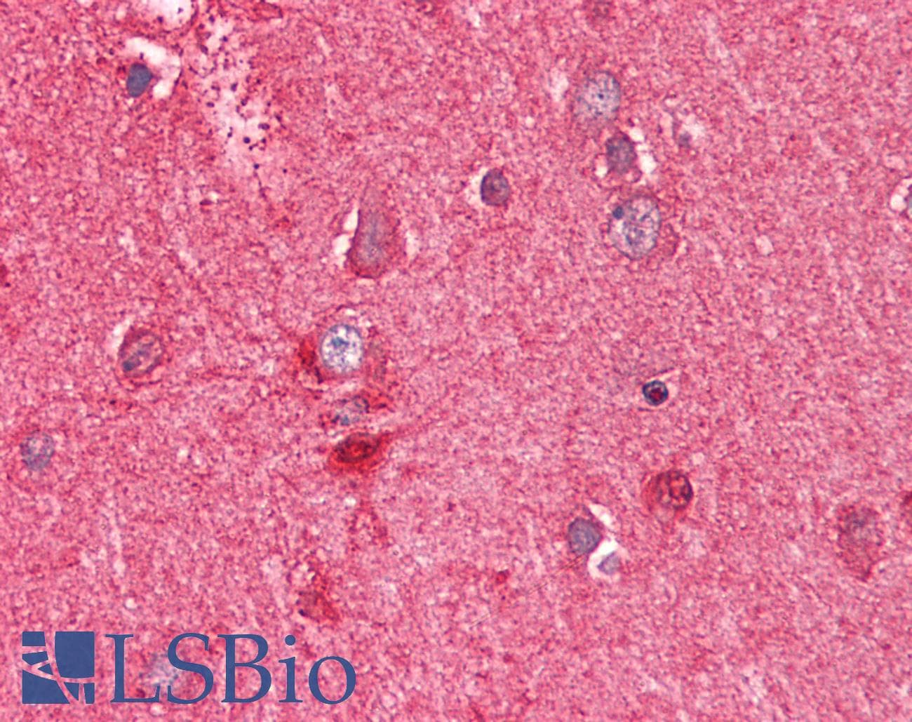 IHC-plus™ PEBP1 / RKIP Antibody (aa175-187)