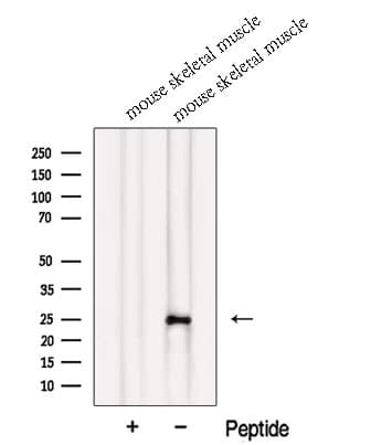 Polyclonal Rabbit anti-Human MXD1 / MAD1 Antibody (WB)