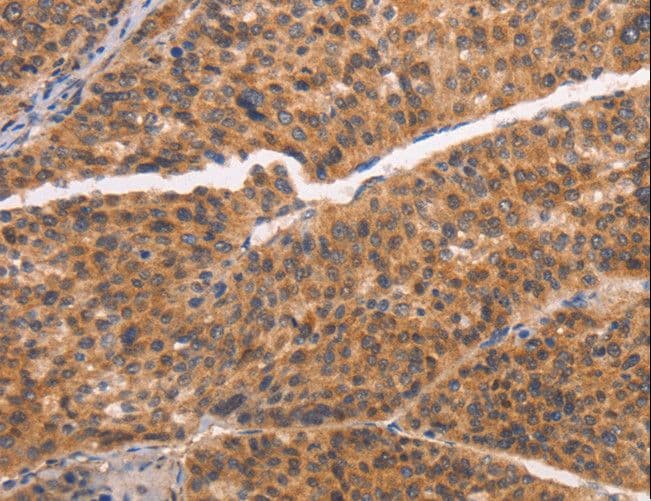Polyclonal Rabbit anti-Human CAP-G2 / MTB Antibody (IHC)