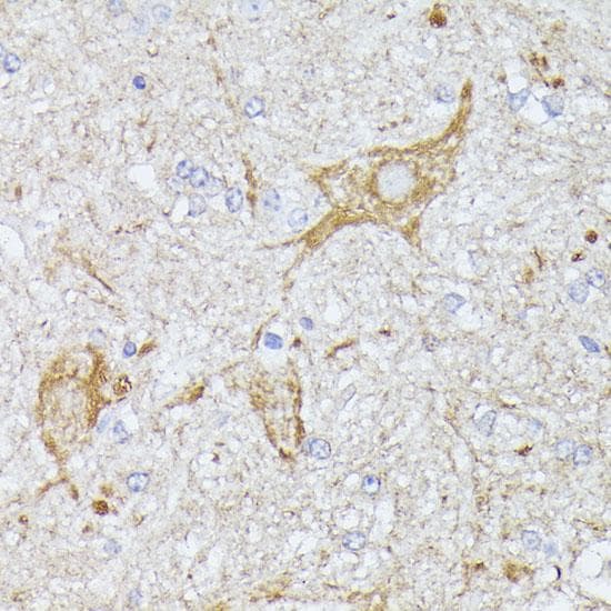TBCA Antibody
