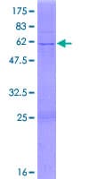 Human HIBADH Protein (Recombinant GST)