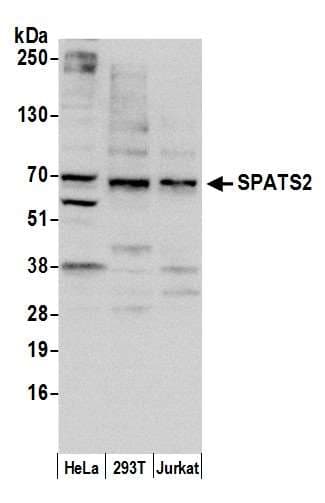 Polyclonal Rabbit anti-Human SPATS2 Antibody (aa495-545, WB)