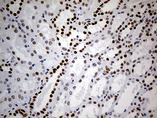 TP53BP1 / 53BP1 Antibody (aa1-300, clone OTI2G3)