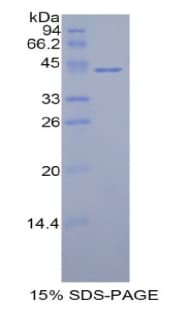 Human HIST1H2AC Protein (Recombinant His-GST)