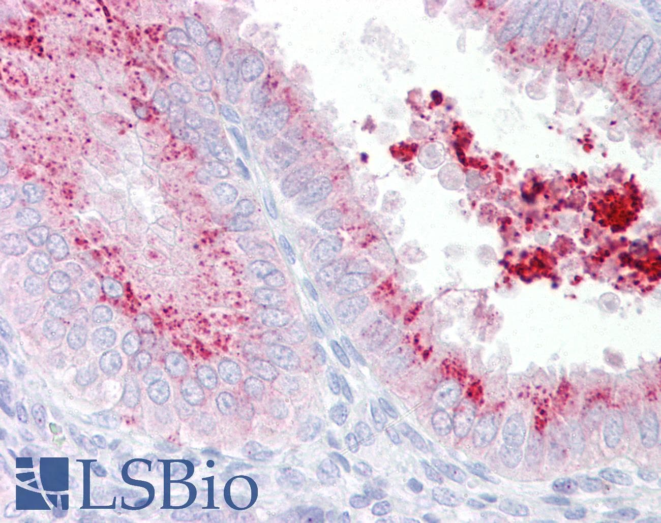 IHC-plus™ Polyclonal Rabbit anti-Human KIAA1324 / maba1 Antibody (IHC, IF, WB)