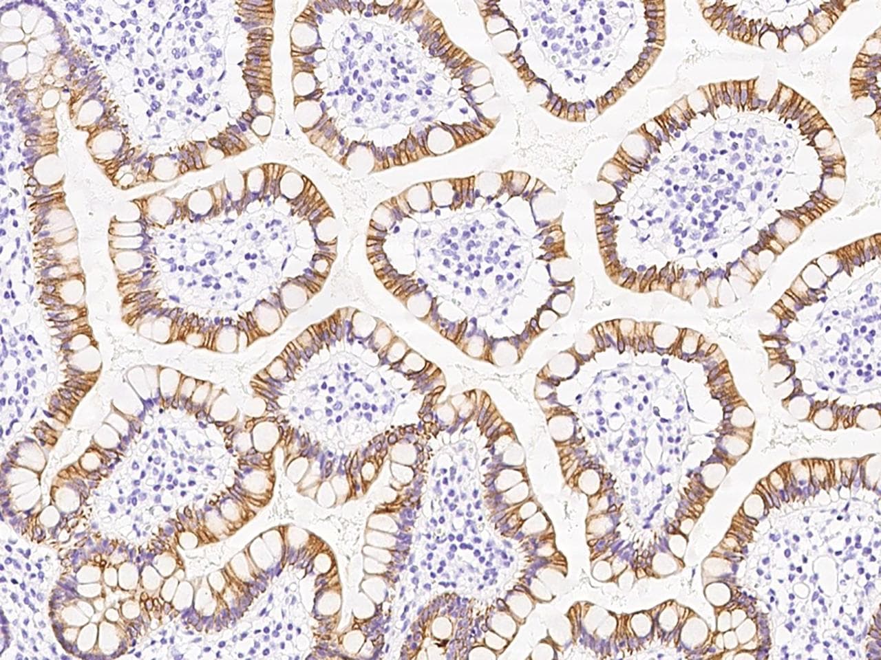 GORAB / SCYL1BP1 Antibody