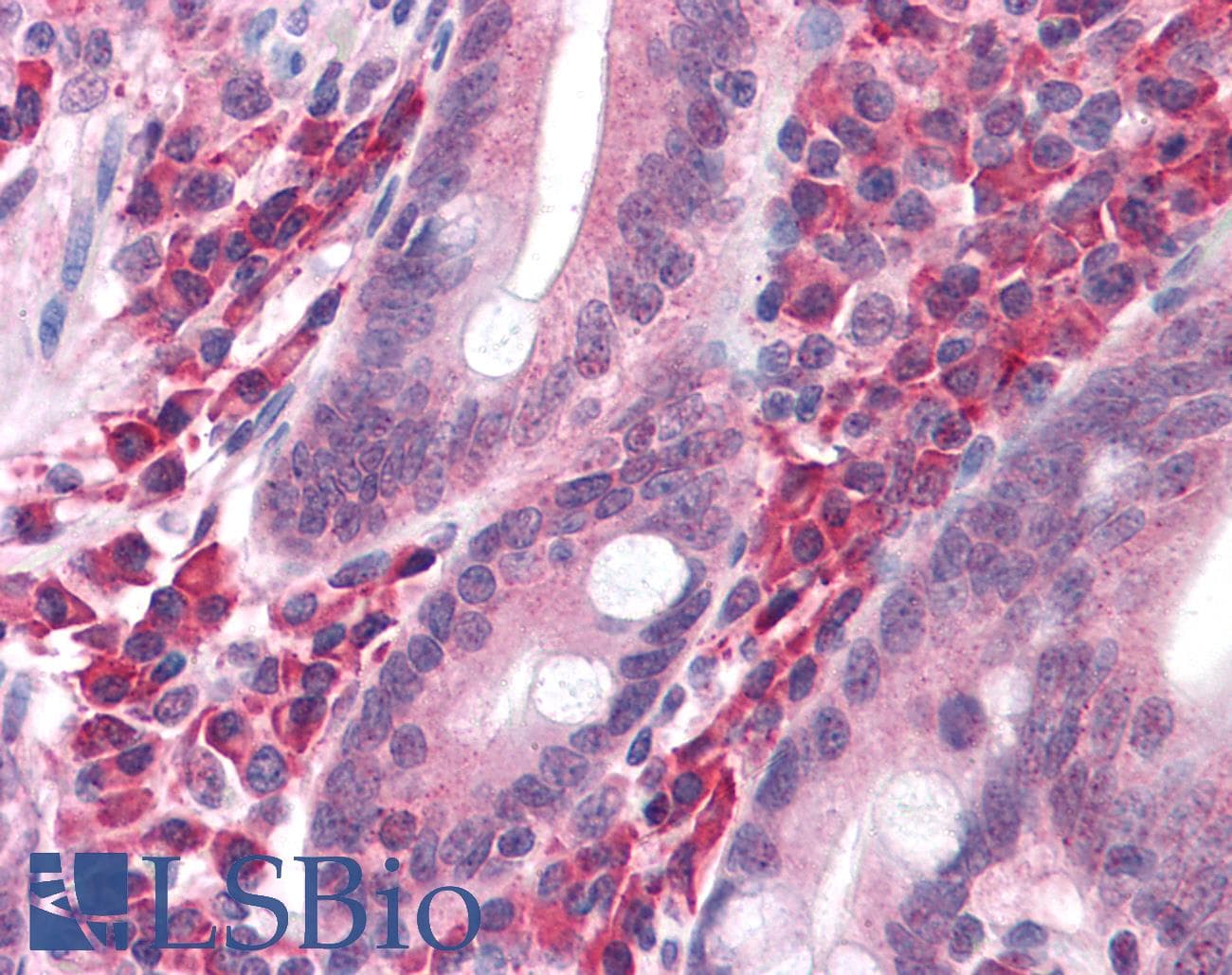 IHC-plus™ Polyclonal Rabbit anti-Human SLC20A1 Antibody (IHC, WB)