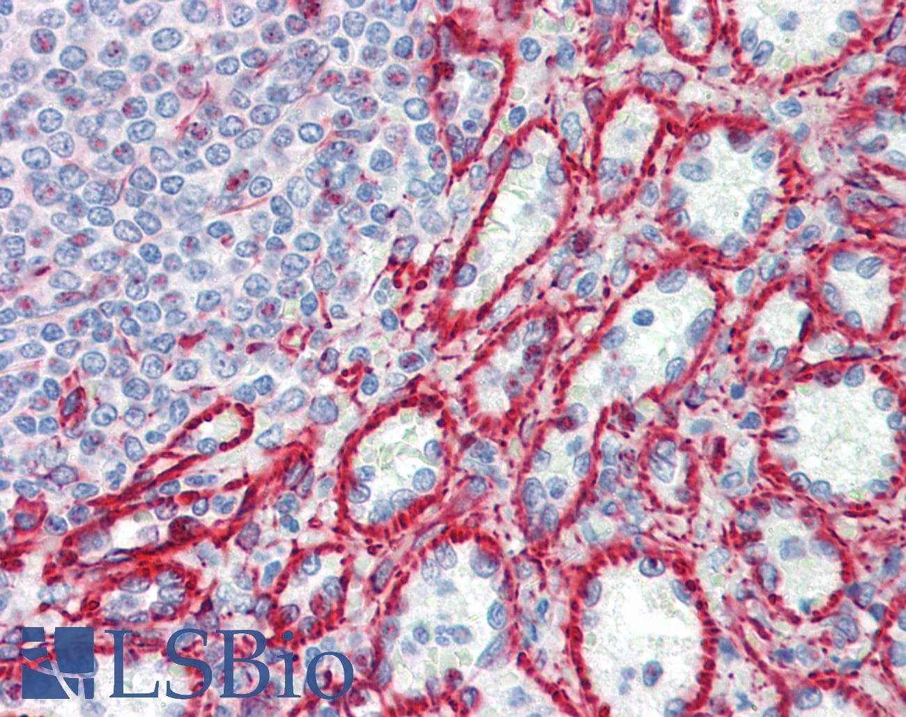 IHC-plus™ RPL30 / Ribosomal Protein L30 Antibody (aa1-30)