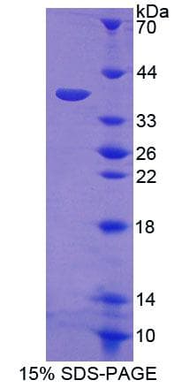 Human PPP6C Protein (Recombinant His,N-terminus)