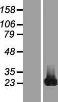 CBFB Protein (Over-Expression Lysate Myc-DDK (Flag))