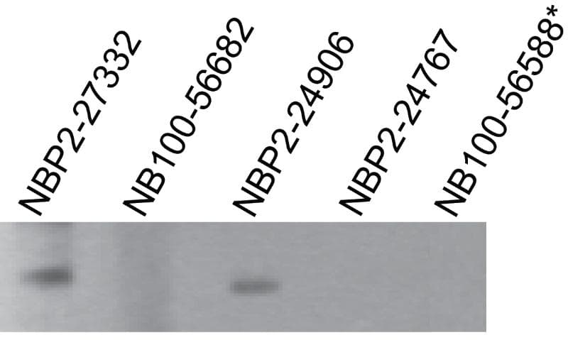 TLR7 / CD287 Antibody (aa562-839, clone 4G6, Azide-free)