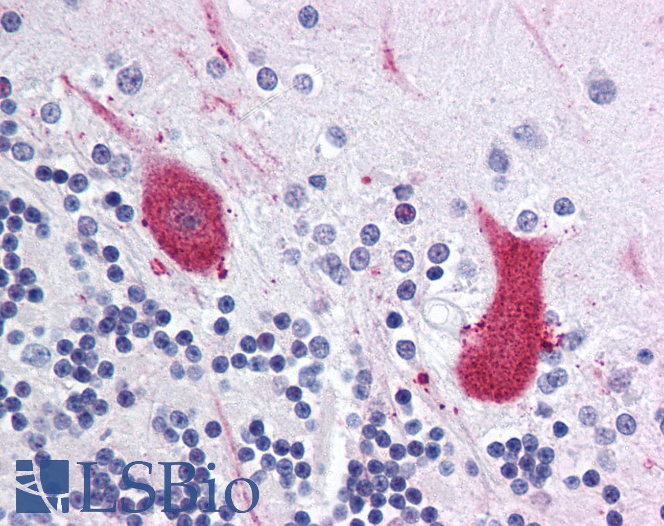 IHC-plus™ MARK1 / MARK Antibody (Internal)