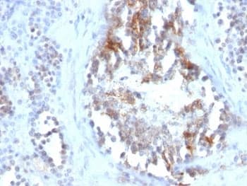 SHBG Antibody (clone SPM605)