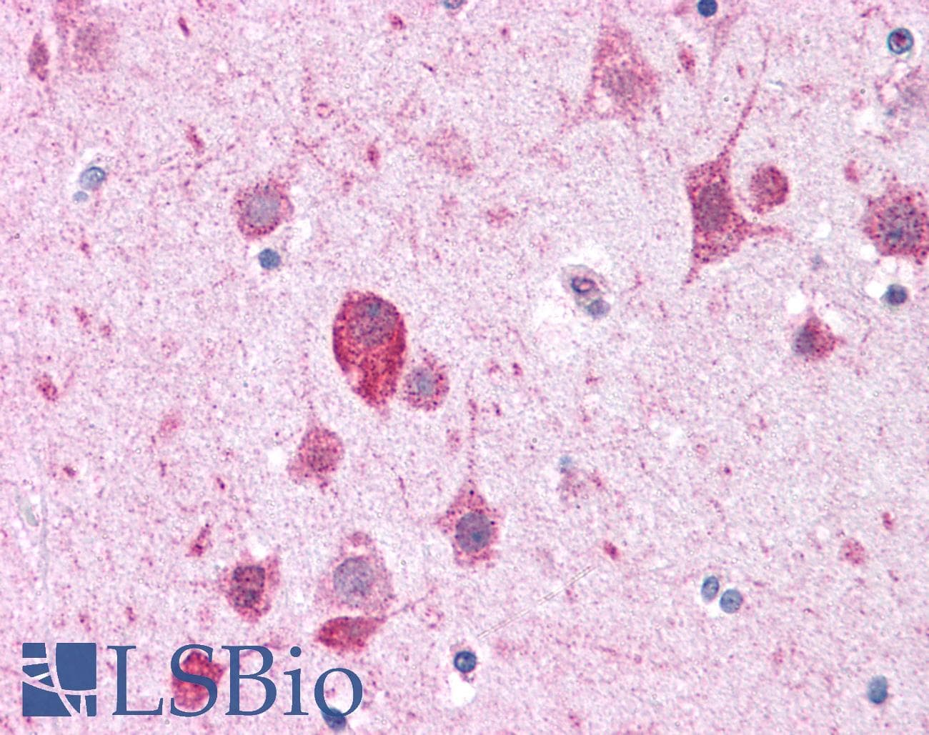 IHC-plus™ CADPS Antibody