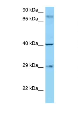 CD274 / B7-H1 / PD-L1 Antibody (aa192-241)