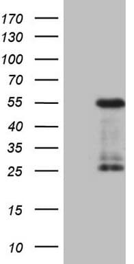 Monoclonal Mouse anti-Human GATA3 Antibody (clone OTI4D5, aa155-443, IF, WB)