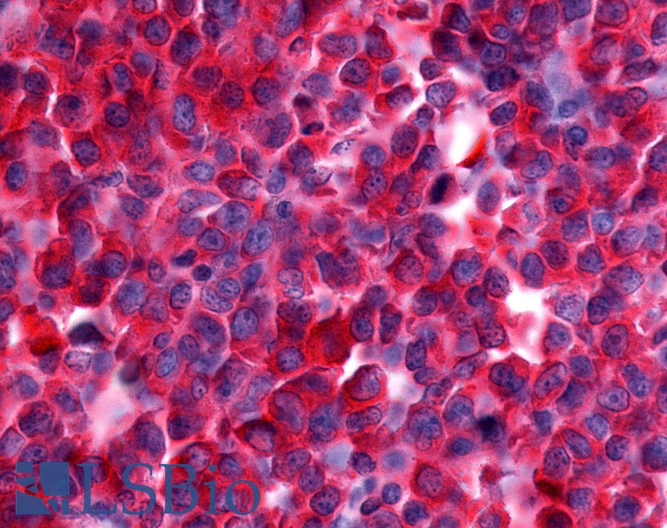 PathPlus™ NEK9 Antibody (Pro/Ser/Thr Rich Domain)