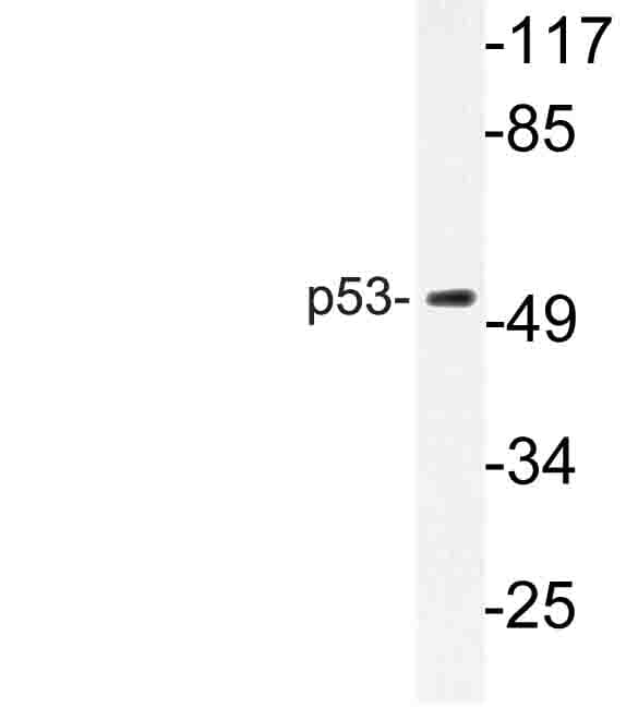 TP53 / p53 Antibody (Val31)