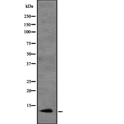 Polyclonal Rabbit anti-Human CCL20 / MIP-3-Alpha Antibody (IHC, WB)