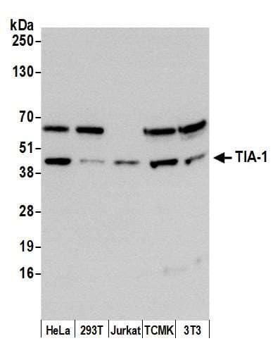 AR / Androgen Receptor Antibody (aa1-50)