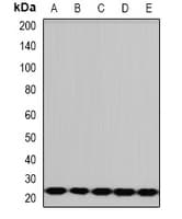 Polyclonal Rabbit anti-Human PCMT1 Antibody (IF, WB)