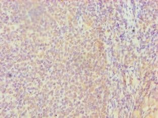 Polyclonal Rabbit anti-Human HBP17 / FGFBP1 Antibody (aa22-232, IHC, WB)