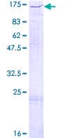 Human NASP Protein (Recombinant GST)