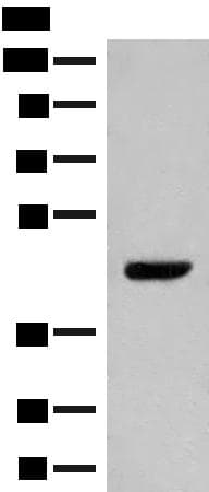 GPR52 Antibody