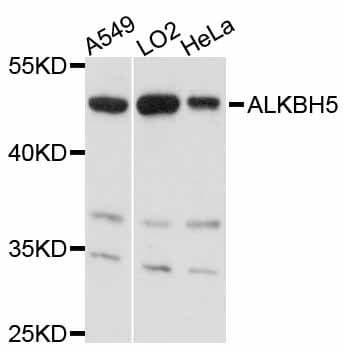 ALKBH5 Antibody