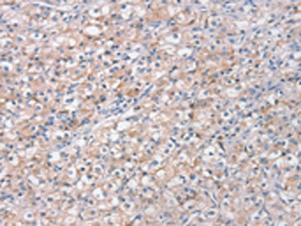 Polyclonal Rabbit anti-Human STK16 Antibody (IHC, WB)