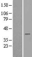 AKR1D1 Protein (Over-Expression Lysate Myc-DDK (Flag))