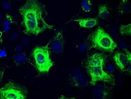 GFAP Antibody (clone OTI4C10)