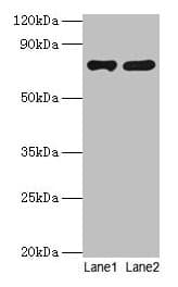 IHC-plus™ PARN Antibody